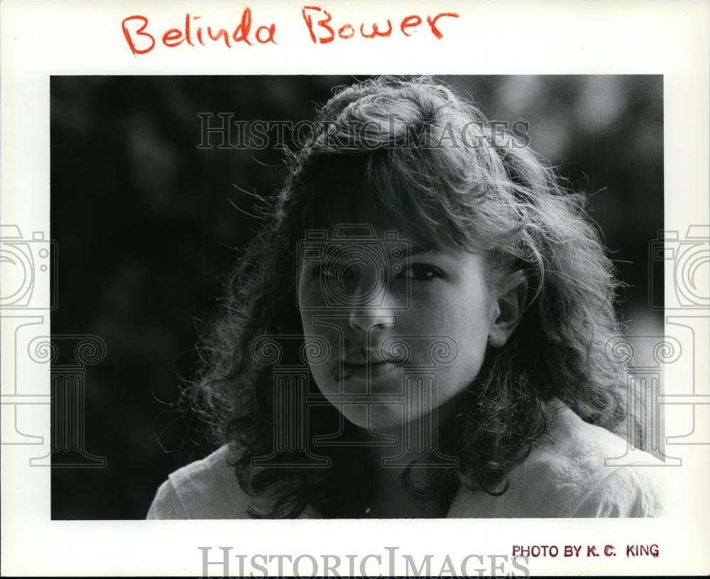 1987 Press Photo Belinda Bauer dog bites to mouth - spa25017 - Historic Images