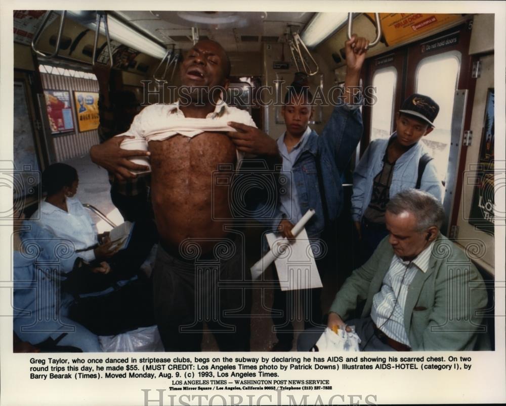 1993 Press Photo Greg Taylor showing his scarred chest on the subway - spa23909 - Historic Images