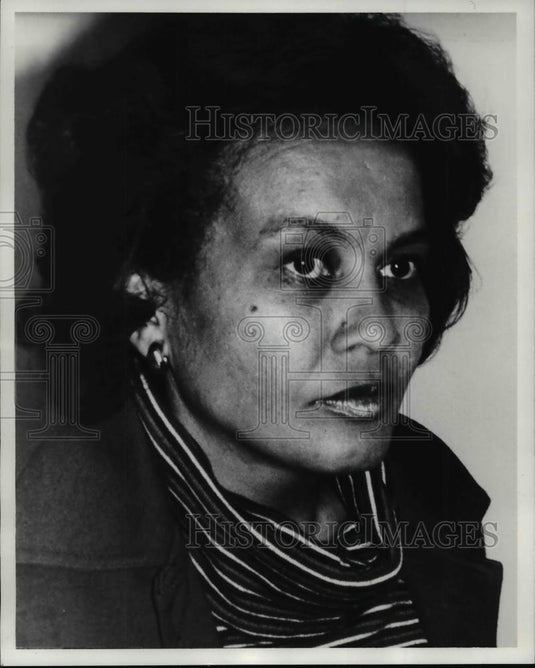 1981 Press Photo Carolyn Smith - cvp98248 - Historic Images