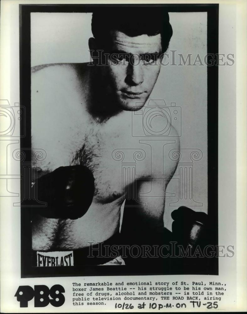 Press Photo James Beattie-boxer - cvp98657 - Historic Images