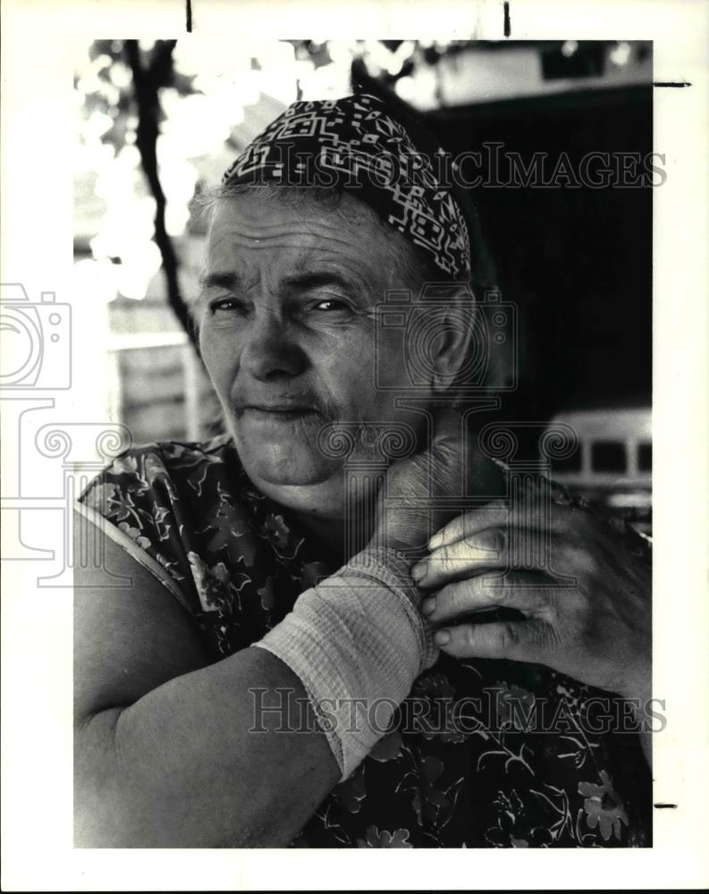 1990 Press Photo Zorka Pavlovic, bitten by a pit bull - cva34440 - Historic Images