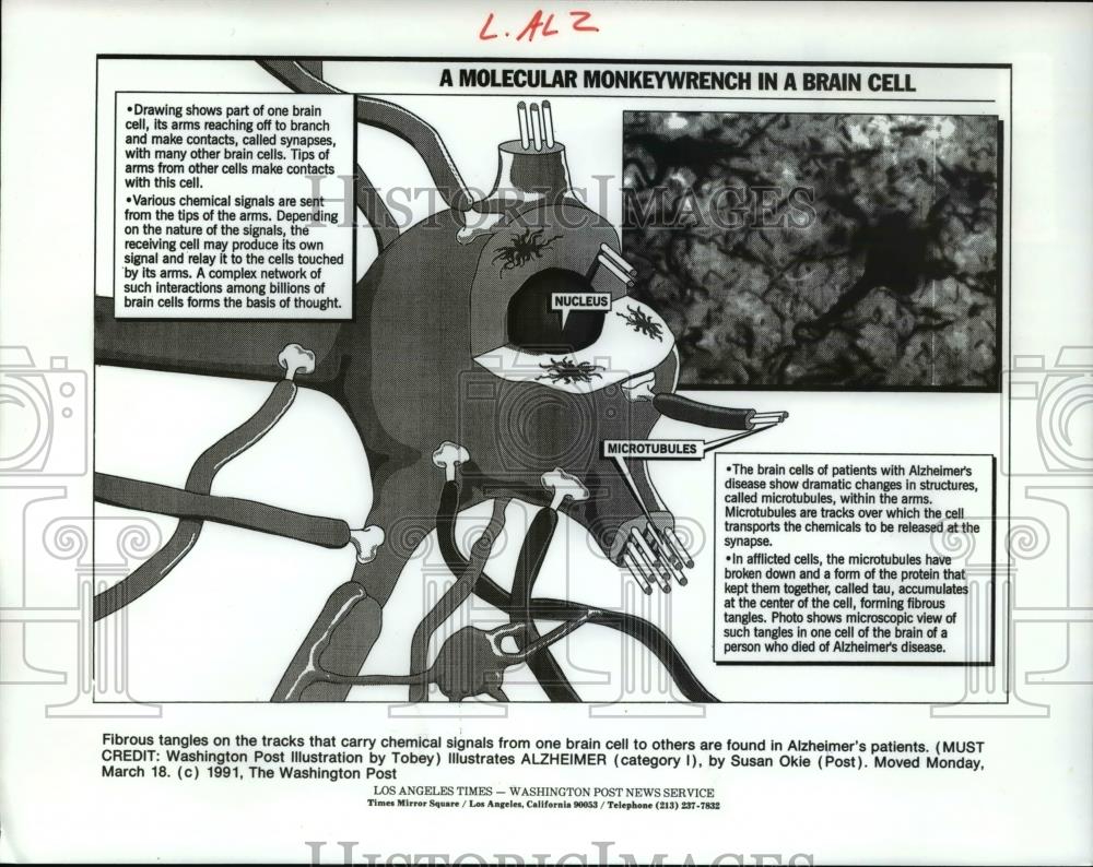 1991 Press Photo A Molecular Monkeywrench in Brain Cell - cva37876 - Historic Images