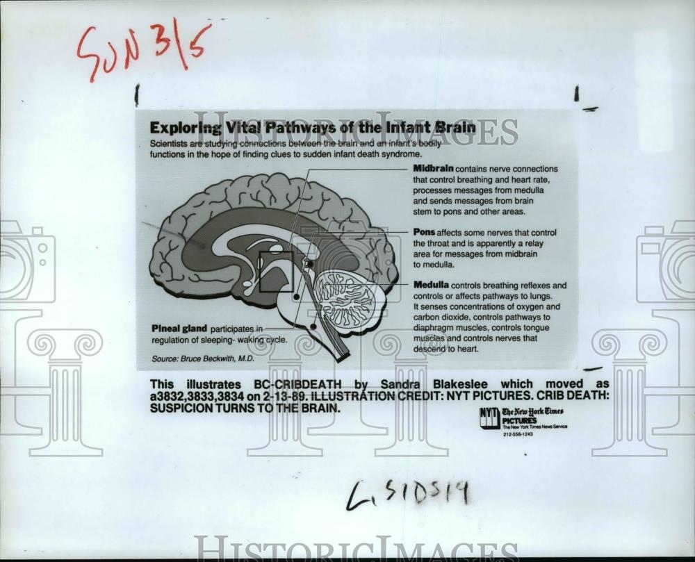1989 Press Photo Illustration of brain for the study of sudden infant death - Historic Images