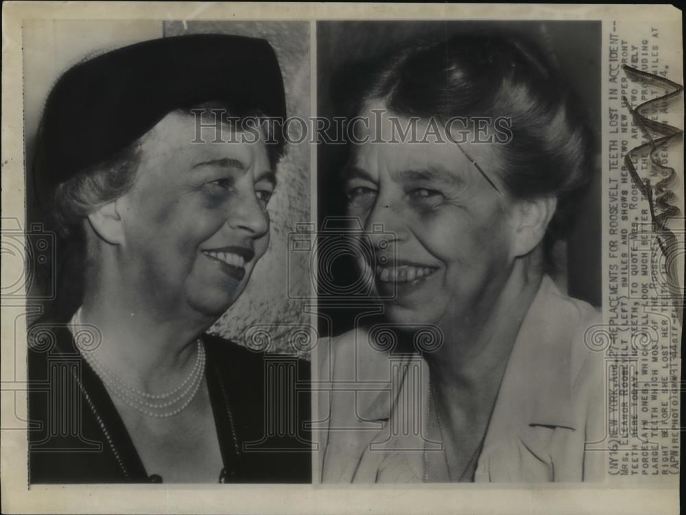 1946 Wire Photo Mrs. Eleanor Roosevelt smiles w/ her two new upper front teeth - Historic Images