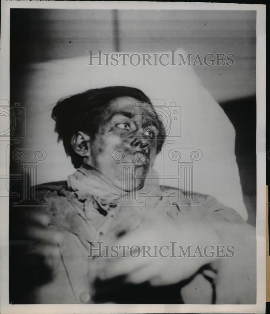 1953 Press Photo A Victim of Explosion in Belgium - nee40427 - Historic Images