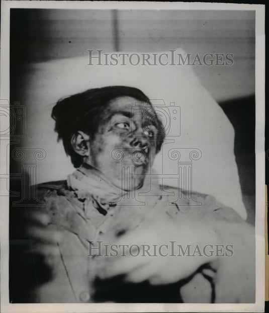 1953 Press Photo A Victim of Explosion in Belgium - nee40427 - Historic Images