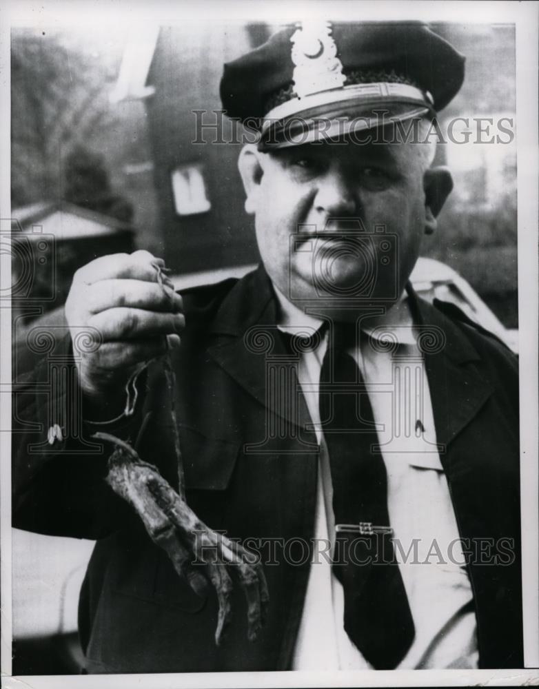 1952 Press Photo Human Hand Found by Police, Charleston, West Virginia - Historic Images