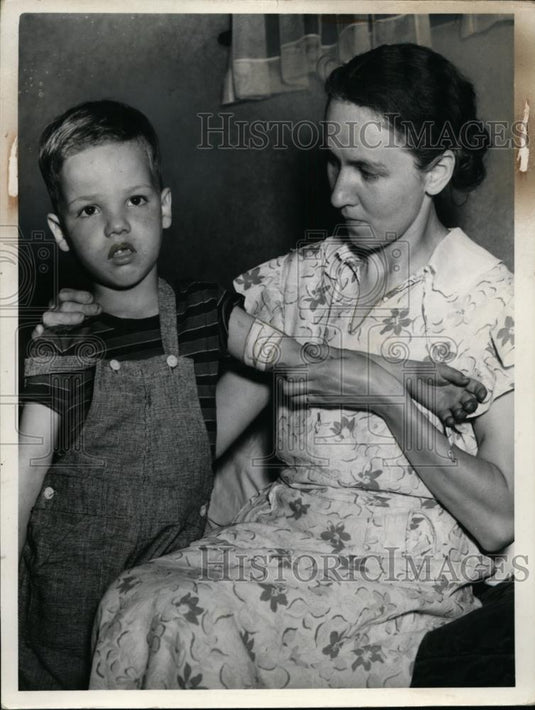 1939 Press Photo Carl Kerekes, Arm Burned by Firecracker, Mother Mrs. S.P. - Historic Images