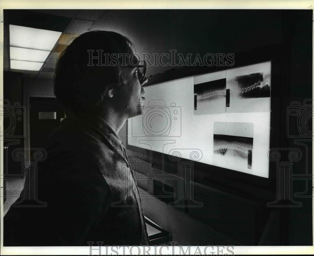 1983 Press Photo Veterinary specialist Steven P Skimmer views Xray of Dachshund - Historic Images