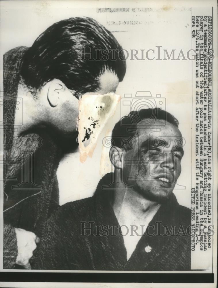 1956 Press Photo Ervin Zador & teammate hurt at water polo vs Russians at Olympi - Historic Images