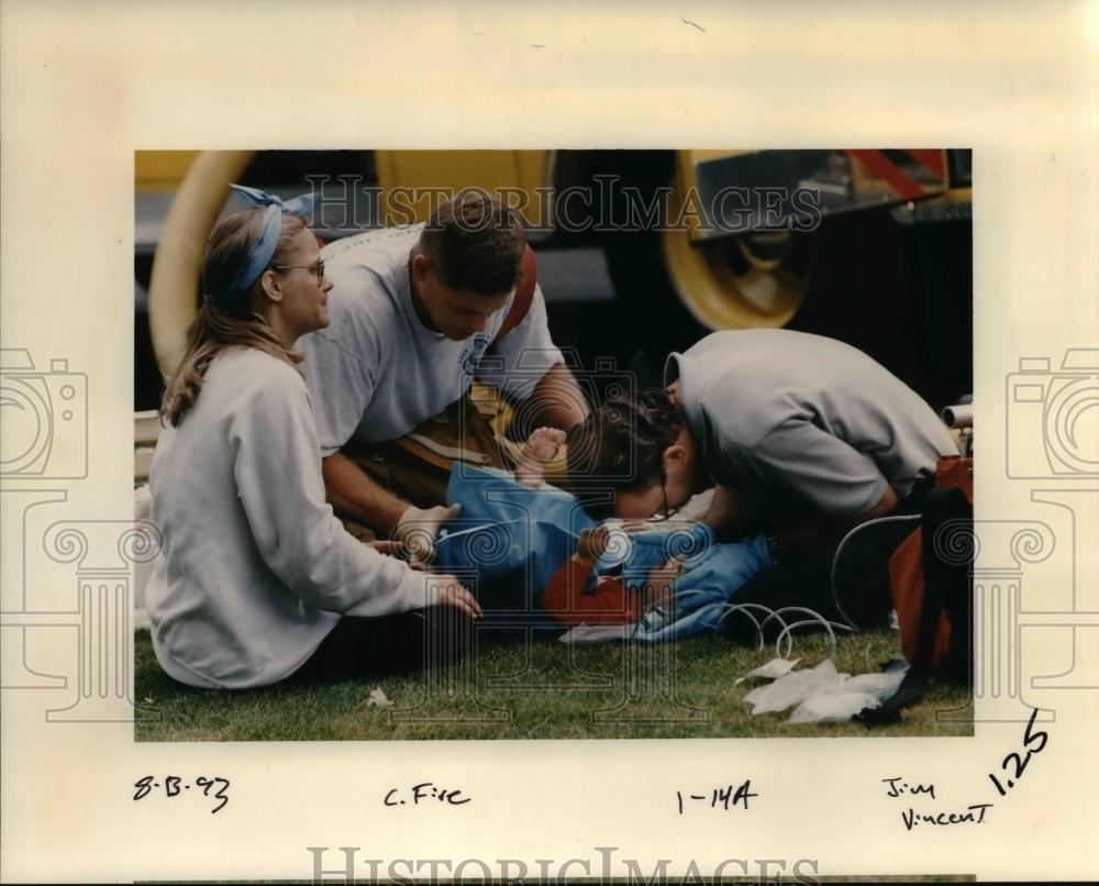 1993 Press Photo Small patient with burns. - orb01290 - Historic Images