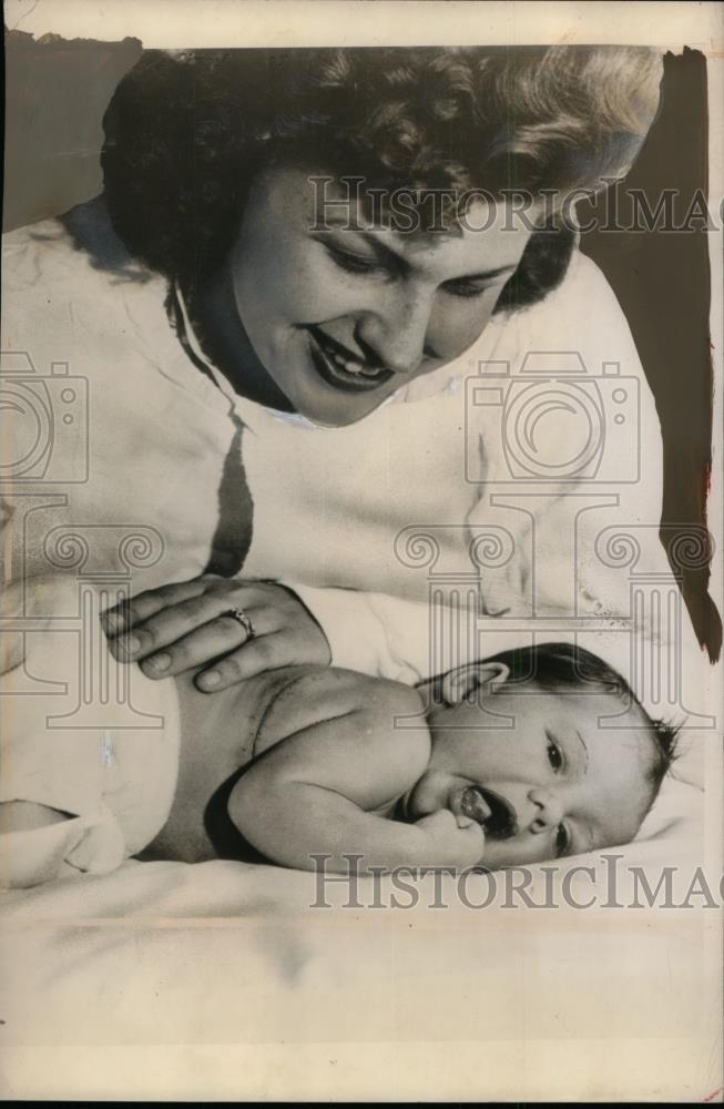 1948 Press Photo Baby John Charles Walters After Cyst Removal Surgery California - Historic Images