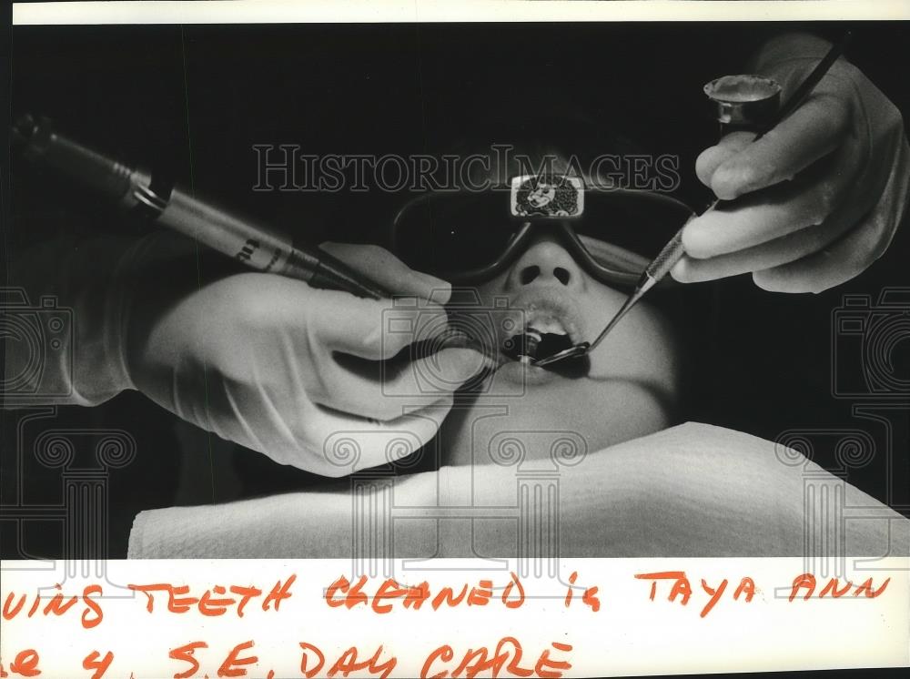 1991 Press Photo Dentistry, Having teeth cleaned is Taya Ann - spa43588 - Historic Images