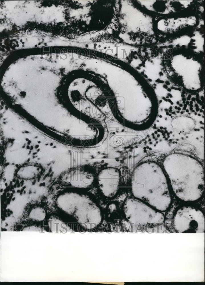 1961 Soviet engineer invented ultramictroton optic nerve frog's eye - Historic Images