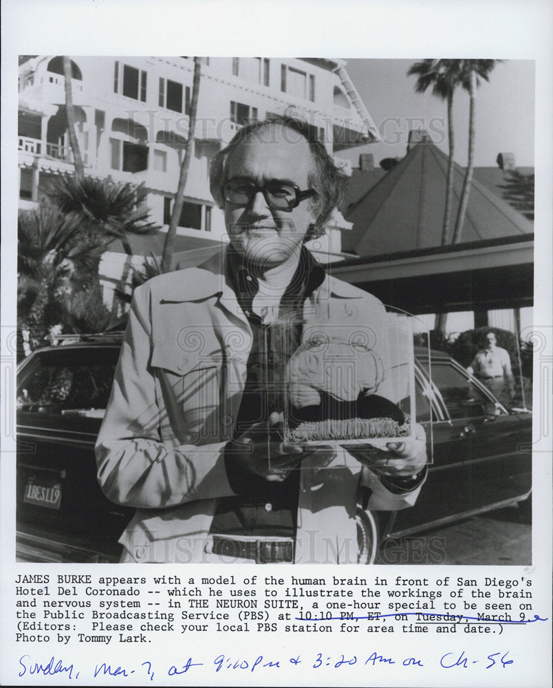 1982 Press Photo James Burke Model Human Brain San Diego Hotel Del Coronado - Historic Images