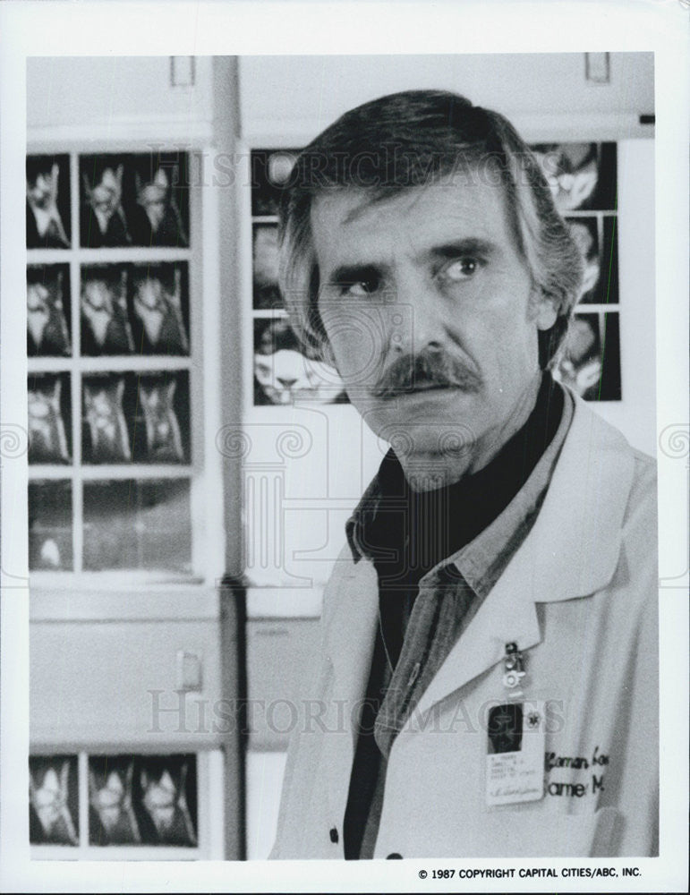 1987 Press Photo Dennis Weaver Actor Buck James Drama Television Series Show - Historic Images