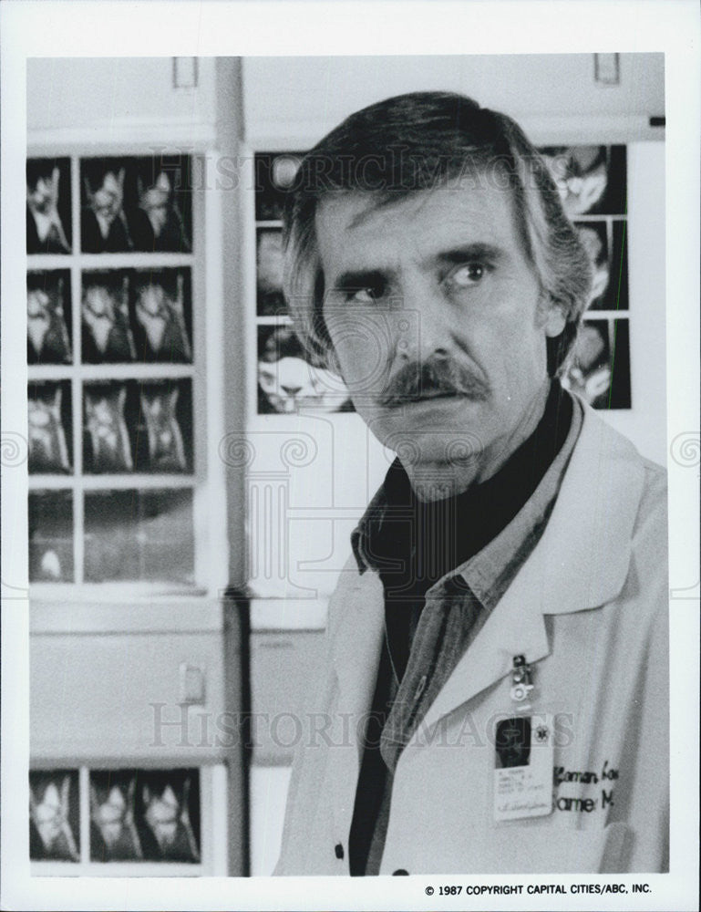 1987 Press Photo Dennis Weaver Actor Buck James - Historic Images