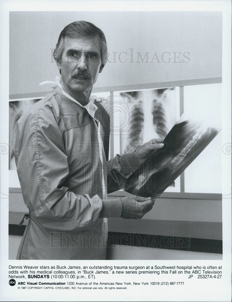 1987 Press Photo Dennis Weaver Actor Buck James - Historic Images