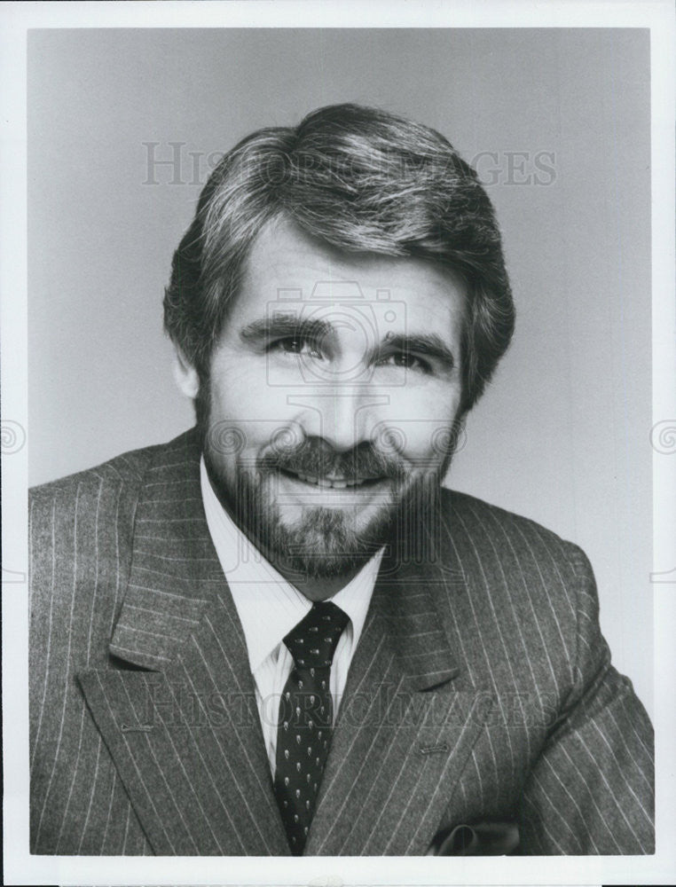 1983 Press Photo James Brolin on &quot;Hotel&quot; - Historic Images