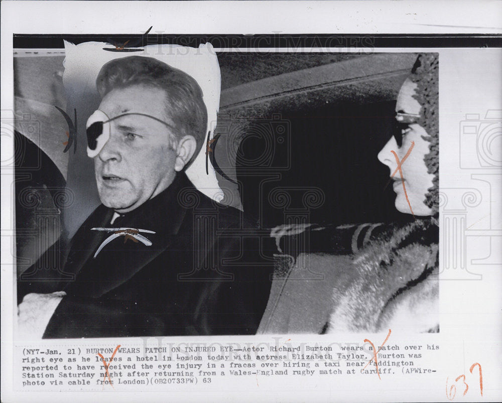 1963 Press Photo Richard Burton with Eye Patch and Liz Taylor - Historic Images