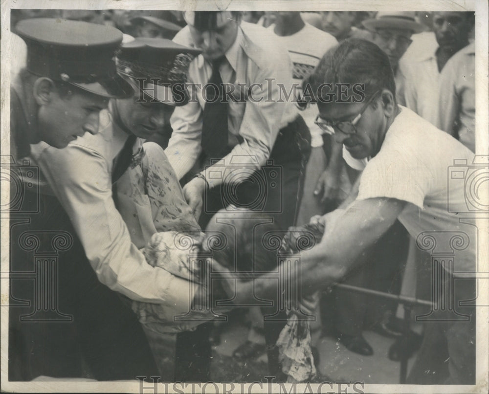 1952 Fireworks Bomb Explode Accident Injury - Historic Images