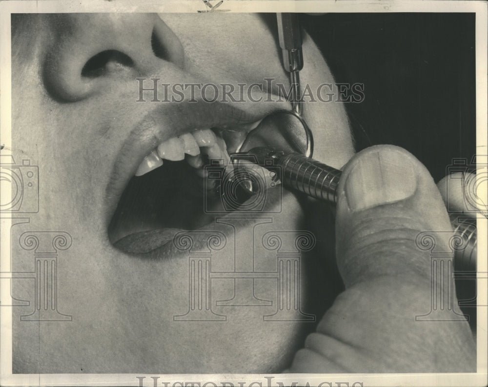 1954 Dr Philip Steen Dental Drill Meet - Historic Images