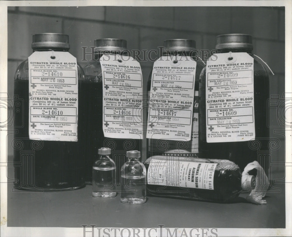 1953 Bottles of Human Blood Used For Polio - Historic Images