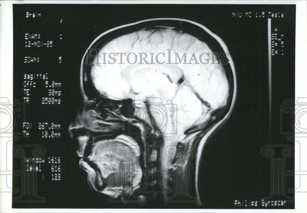 1993 Press Photo Magnetic Resonance Medical Center