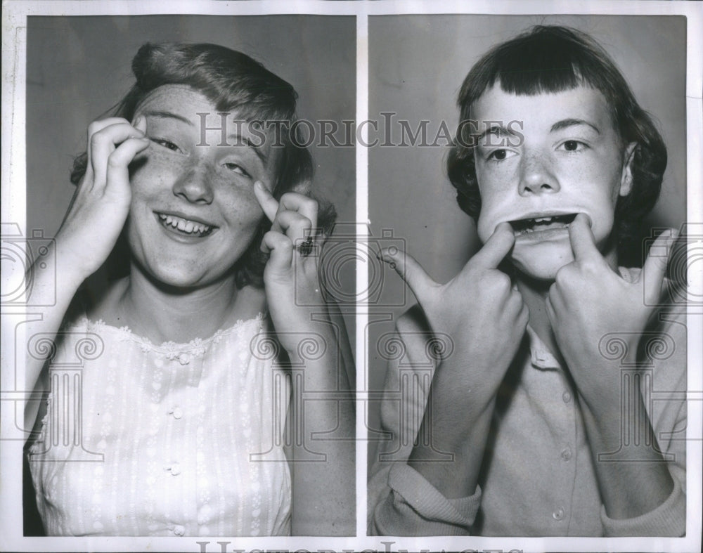 1957 Press Photo Face Central Sense Complex Animal Skin