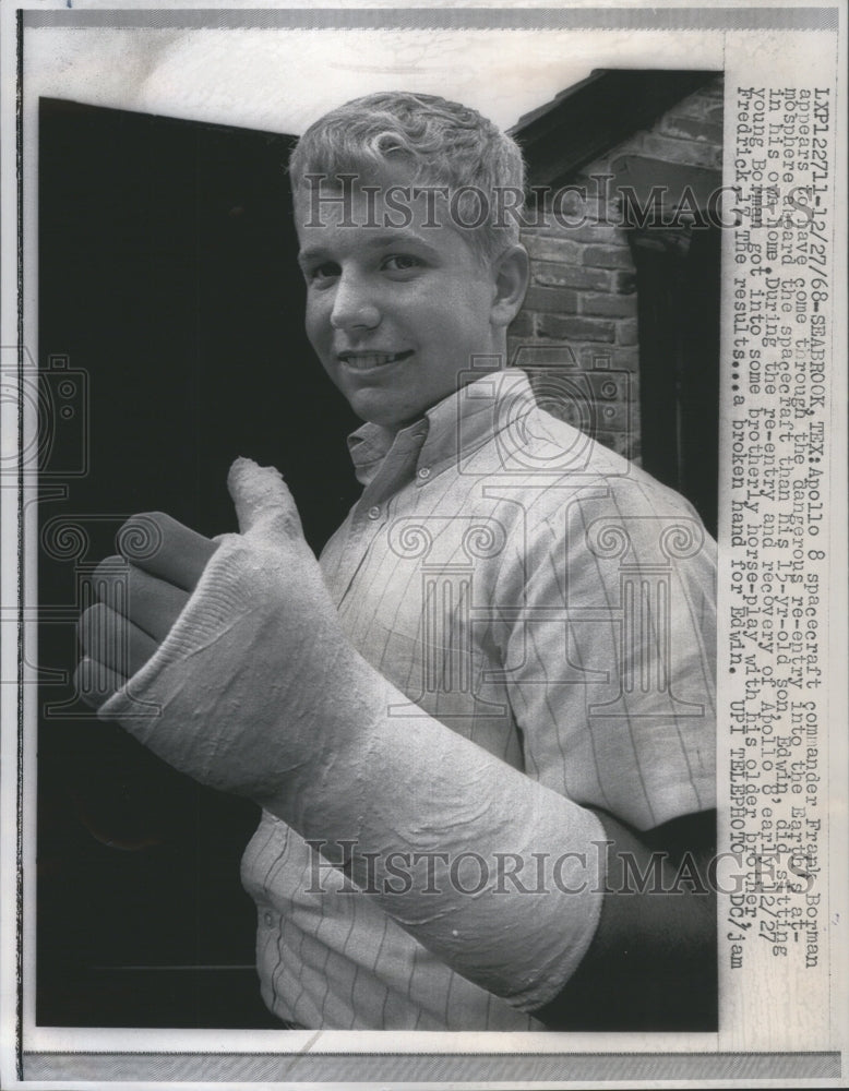 1968 Press Photo Edwin showing Broken Hand