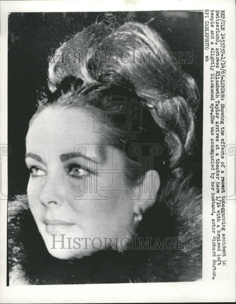 1965 Elizabeth Taylor Sledding Accident - Historic Images