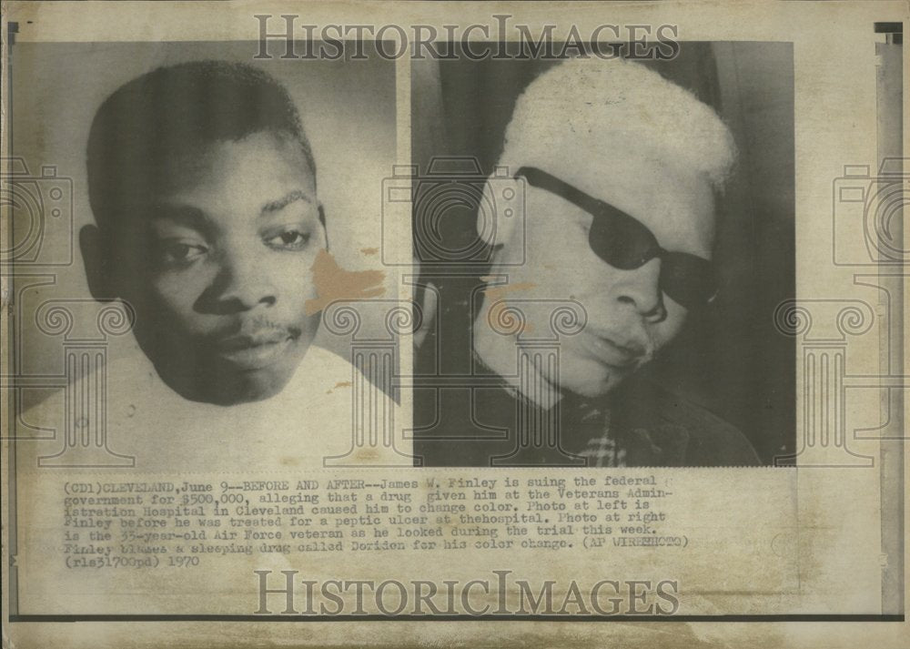 1970 Negro Vet. Lawsuit VA Hosp Negligence - Historic Images