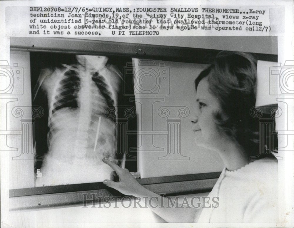 1965 X-Ray Technician Joan Edmonds - Historic Images