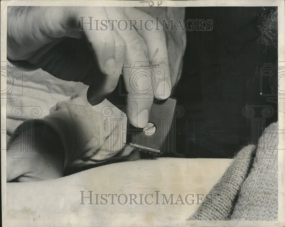 1950 Doctor BCG TB Vaccine Needles Puncture - Historic Images