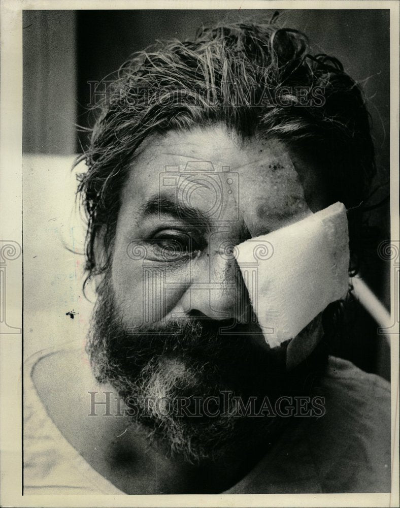 1980 Robert DeLaney Was mugged - Historic Images