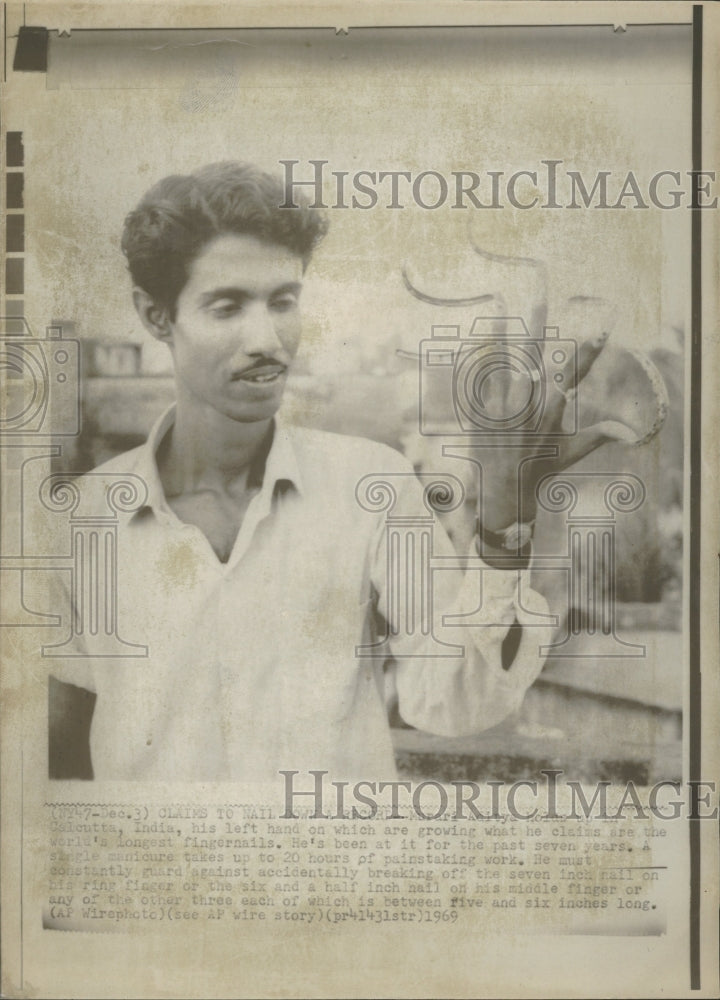 1969 Man Grows World&#39;s Longest Fingernails - Historic Images