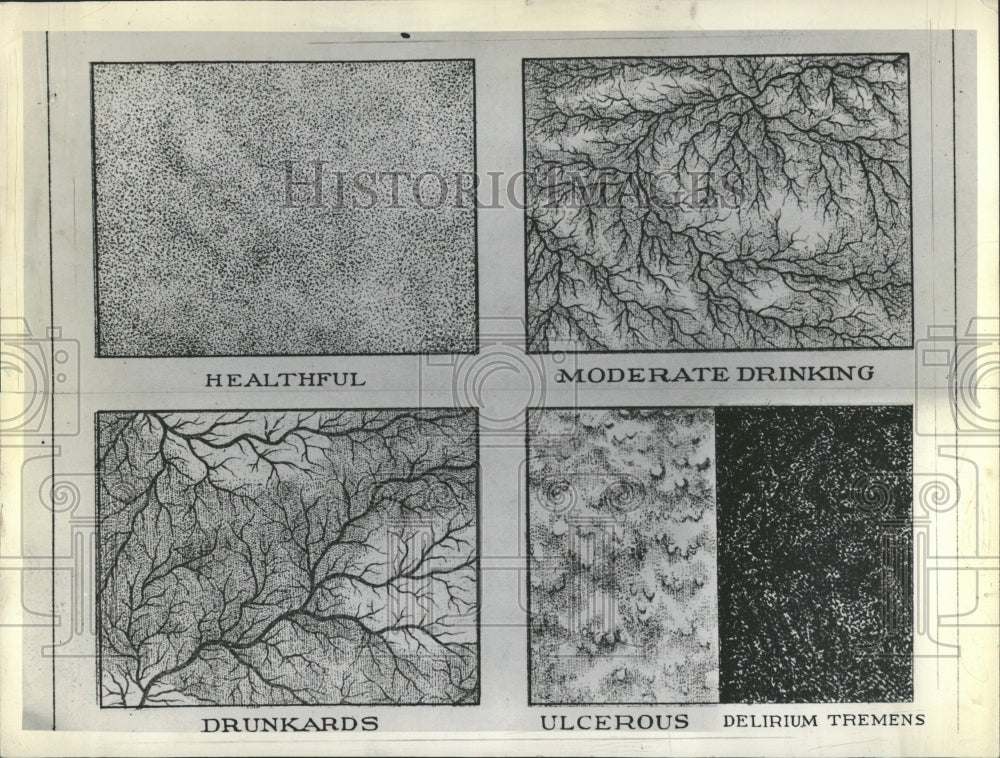 1936 Stomach chart on Drinking - Historic Images