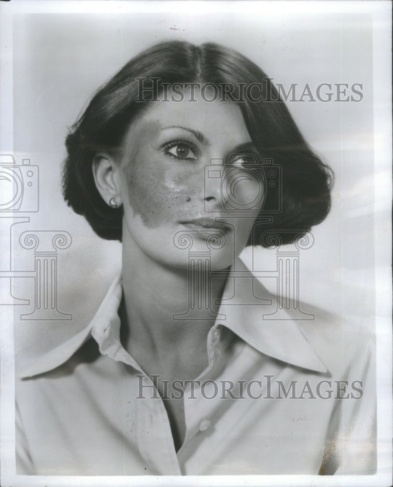 1979 Hiding Unsighlty Blemish Women Men - Historic Images