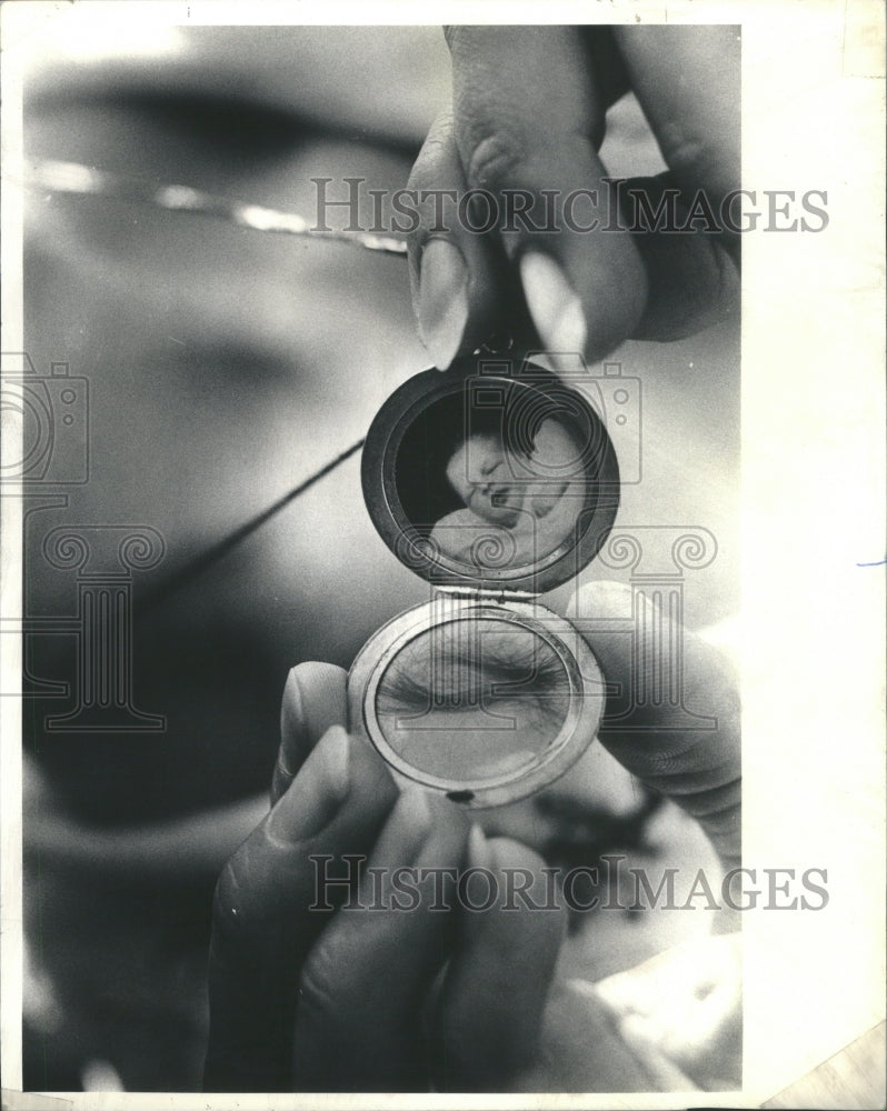 1987 Press Photo Victim Of SIDS - Historic Images