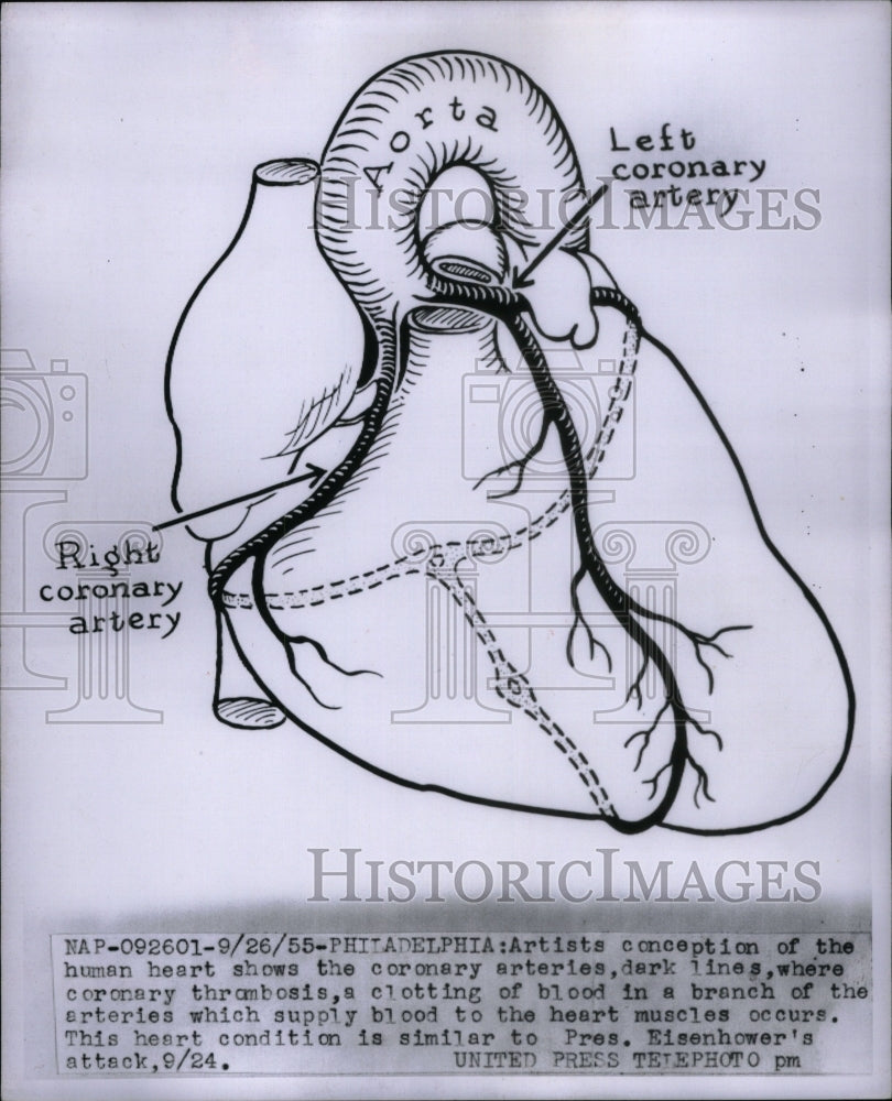 1955 Press Photo Artists Conception human heart lines - Historic Images