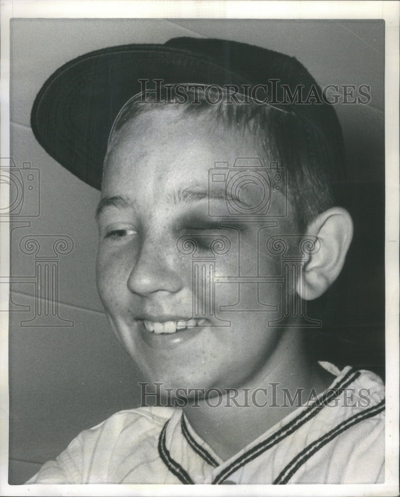 1963 Black Eye Bruce Koontz BaseballPitcher-Historic Images