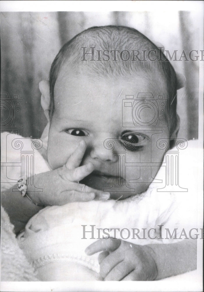1966, Anna Marie Patsions Baby with Blackeye - RRU79123 - Historic Images