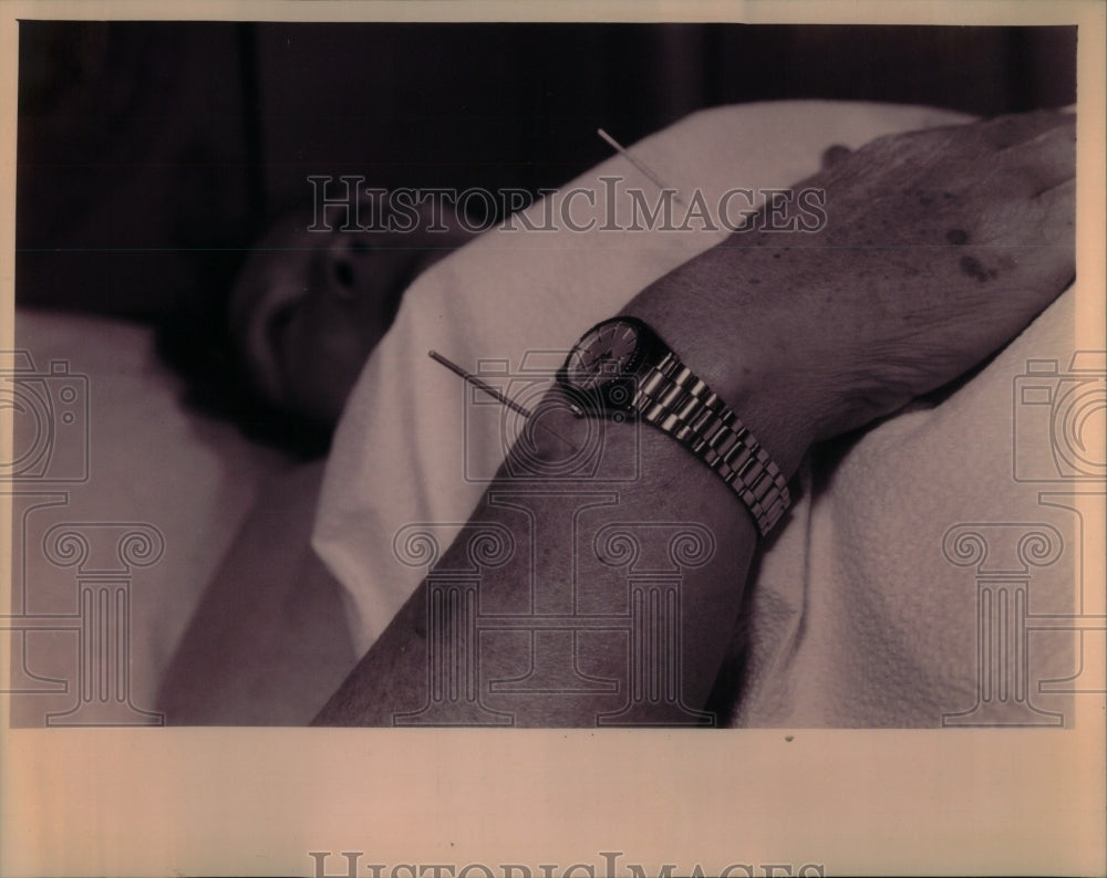 1994 Acupuncture Treatments MD Scan 3D - Historic Images
