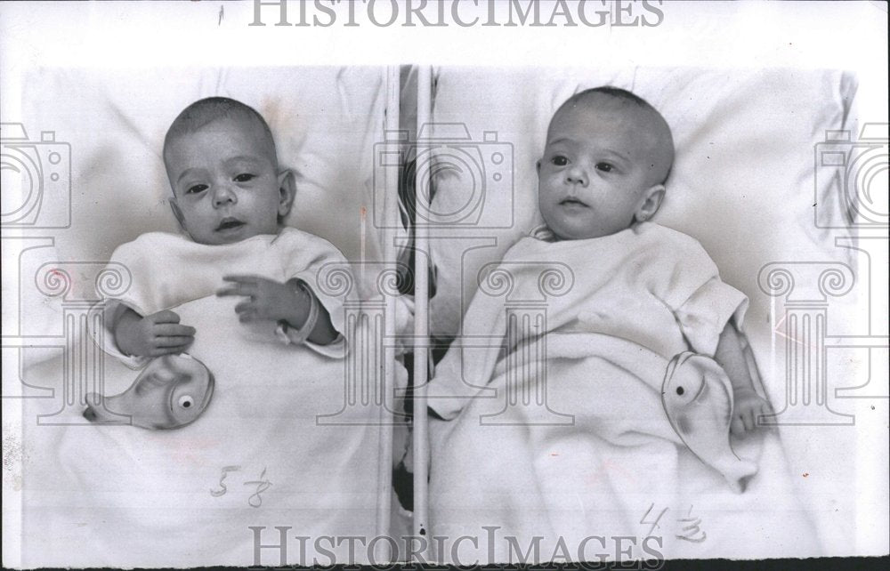 1953 Siamese Twins Catherine Carolyn Anne - Historic Images