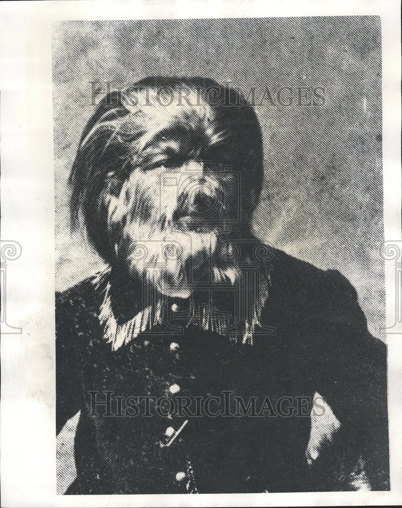 1976 Press Photo Hairy face person being exhibited - Historic Images