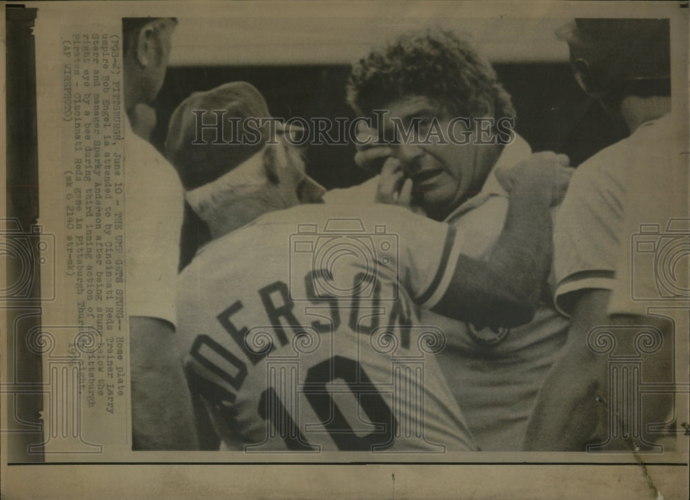 1976 Press Photo Bob Engel Umpire Bee Sting - RRW04523 - Historic Images