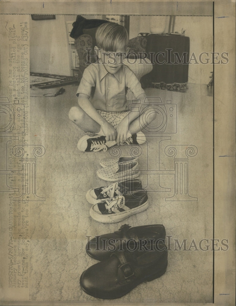 1970 Press Photo Hormone Scott Lau pairs shoes Grouth - RRW40795 - Historic Images