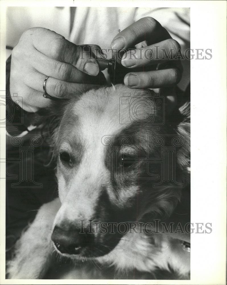 1982 Press Photo Acupuncture needle used to treat migra - RRW41825 - Historic Images