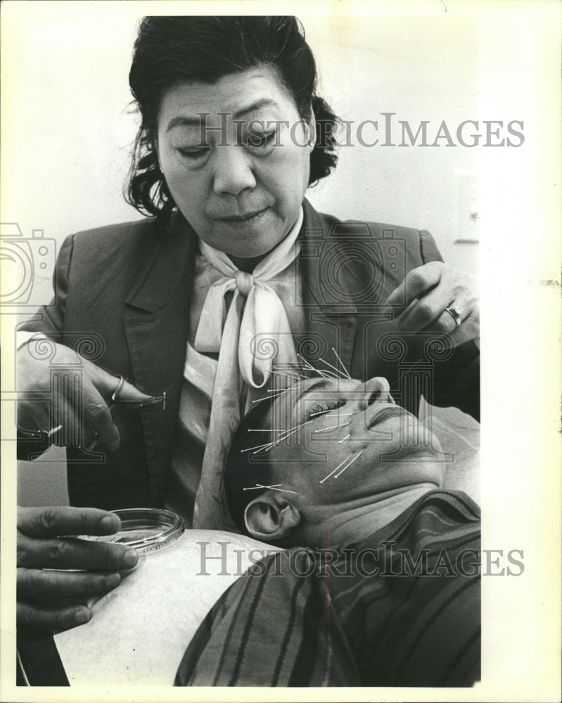 1982 Press Photo Acupuncture Treatment by Dr,.Mary Lo. - RRW41837 - Historic Images