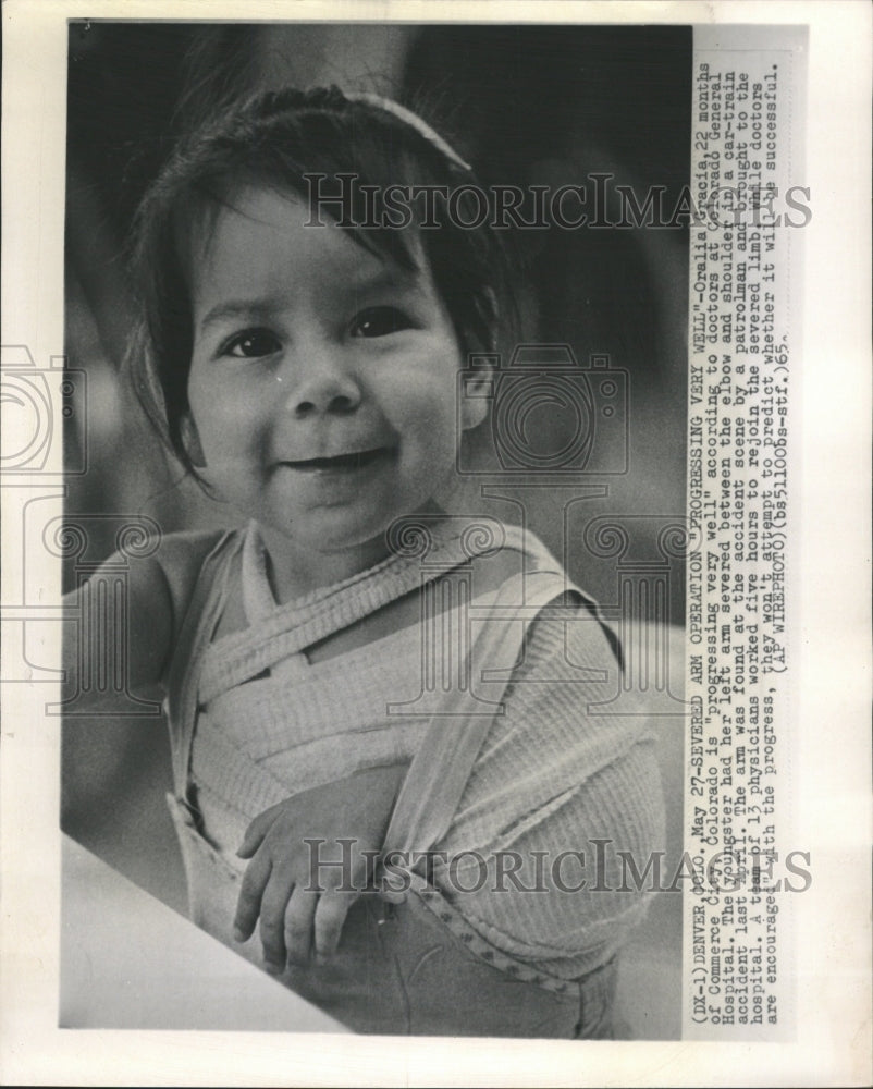 1965 Press Photo Girl Arm Sling Colorado Accident - RRW44291 - Historic Images
